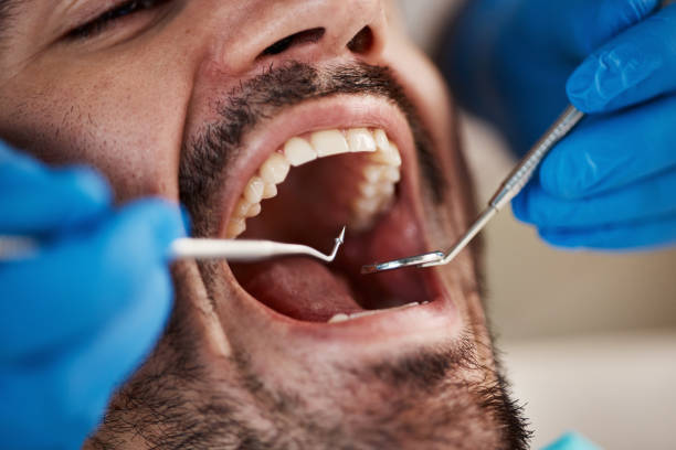 Best Emergency Care for Gum Disease in Lake Lotawana, MO